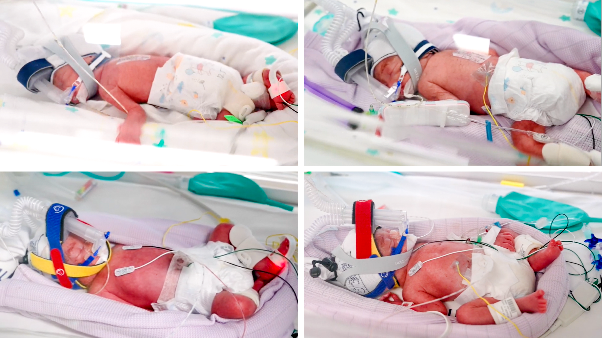 Australia’s Rare Quad Birth Stuns Health Community