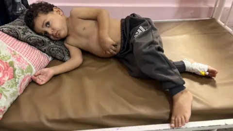 Gaza's Children in Urgent Need: Dying While Awaiting Evacuations