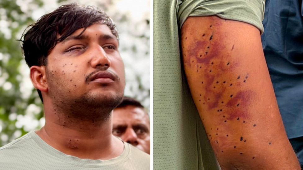 Pellet Gun Wounds Confirmed in Delhi Protest, Experts Say