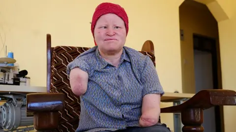 Election Time: A Living Nightmare for Tanzania's Albinism Community