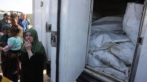 Doctors in Gaza Face Daunting Challenges in Investigating Signs of Torture on Returned Bodies